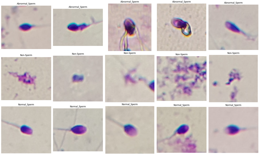 Sperm Morphology images Dataset Classification